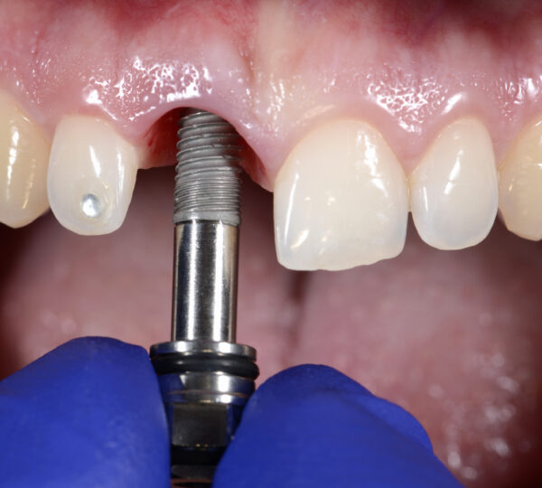 Westchester Family Dental Implant Center